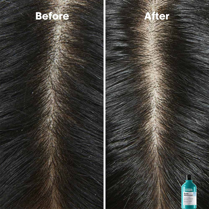 L'Oréal Professionnel Serie Expert Scalp Advanced Anti-Dandruff Dermo Clarifier Shampoo 300ml