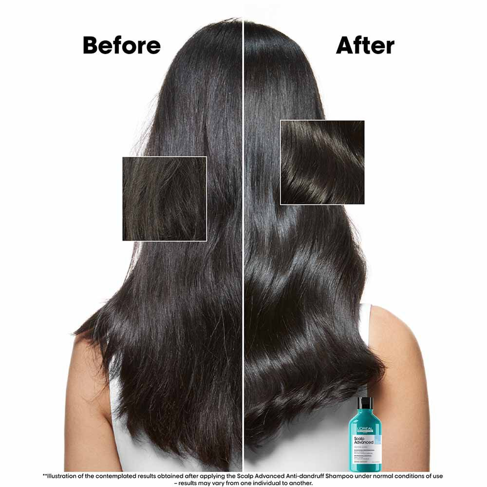 L'Oréal Professionnel Serie Expert Scalp Advanced Anti-Dandruff Dermo Clarifier Shampoo 300ml