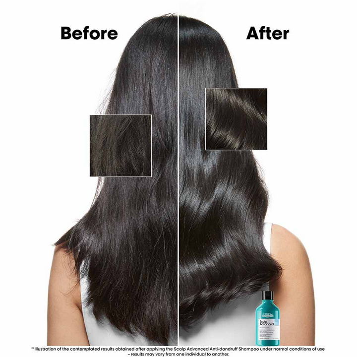 L'Oréal Professionnel Serie Expert Scalp Advanced Anti-Dandruff Dermo Clarifier Shampoo 300ml