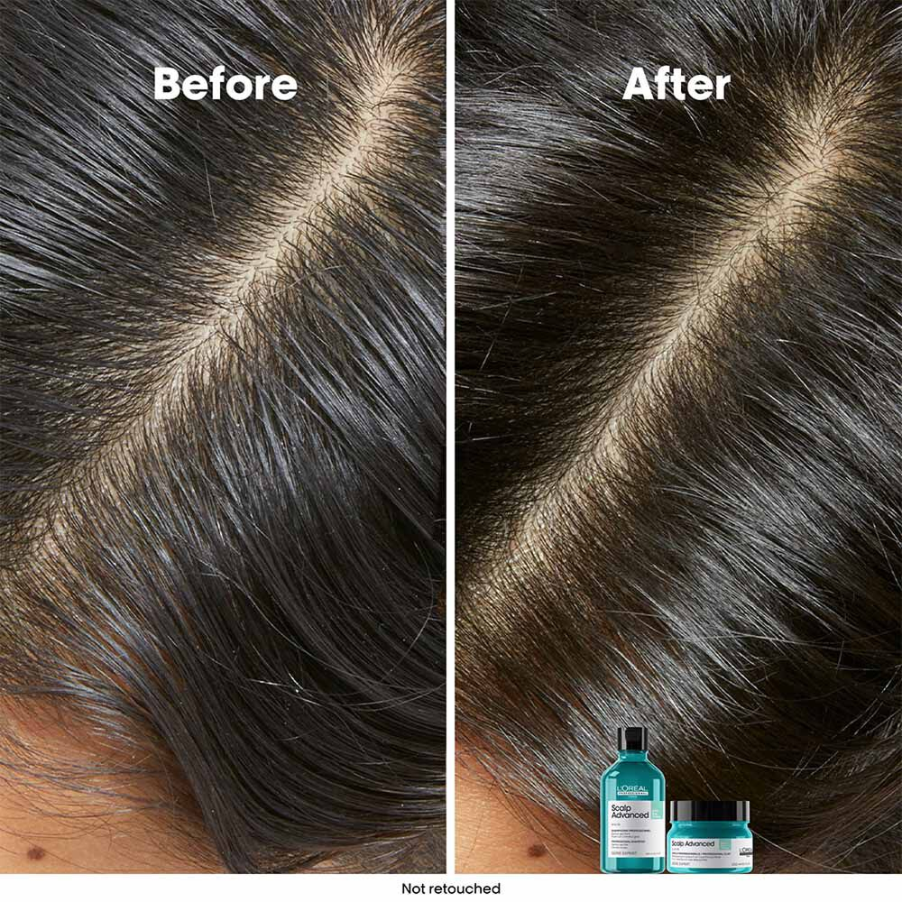 L'Oréal Professionnel Serie Expert Scalp Advanced Anti-Oiliness Dermo Purifier Shampoo 300ml