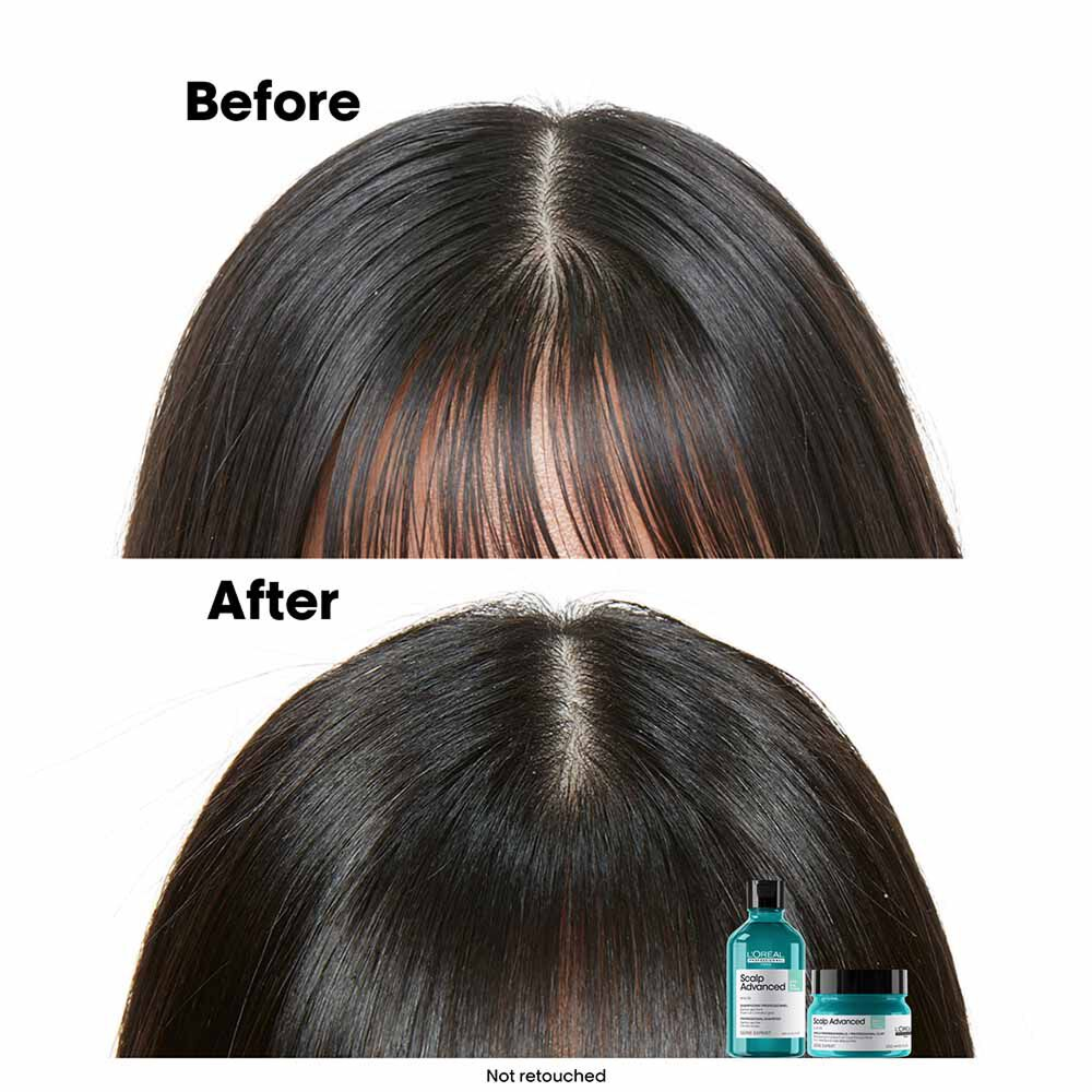 L'Oréal Professionnel Serie Expert Scalp Advanced Anti-Oiliness Dermo Purifier Shampoo 300ml