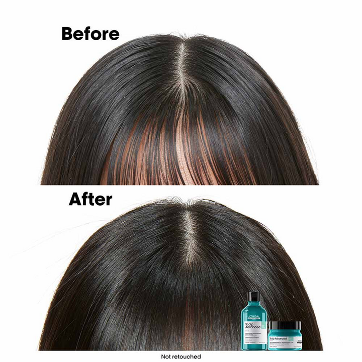 L'Oréal Professionnel Serie Expert Scalp Advanced Anti-Oiliness Dermo Purifier Shampoo 300ml