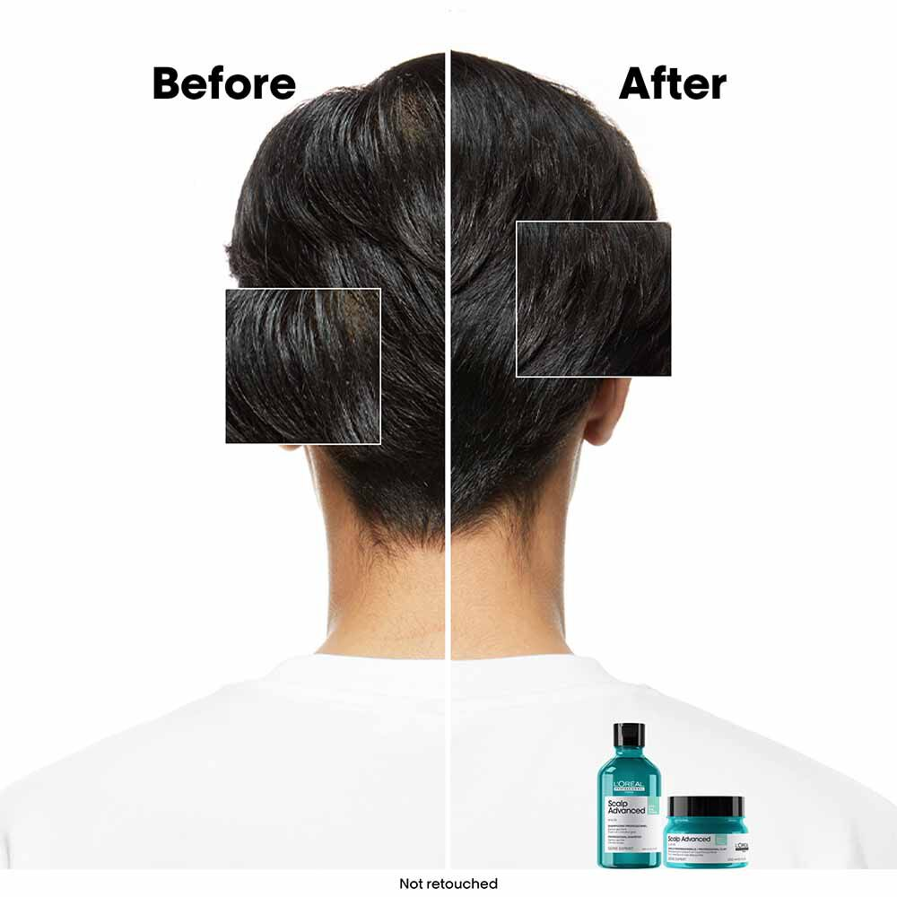 L'Oréal Professionnel Serie Expert Scalp Advanced Anti-Oiliness Dermo Purifier Shampoo 300ml