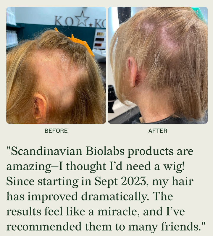 Scandinavian Biolabs Bio-Pilixin Conditioner WOMEN
