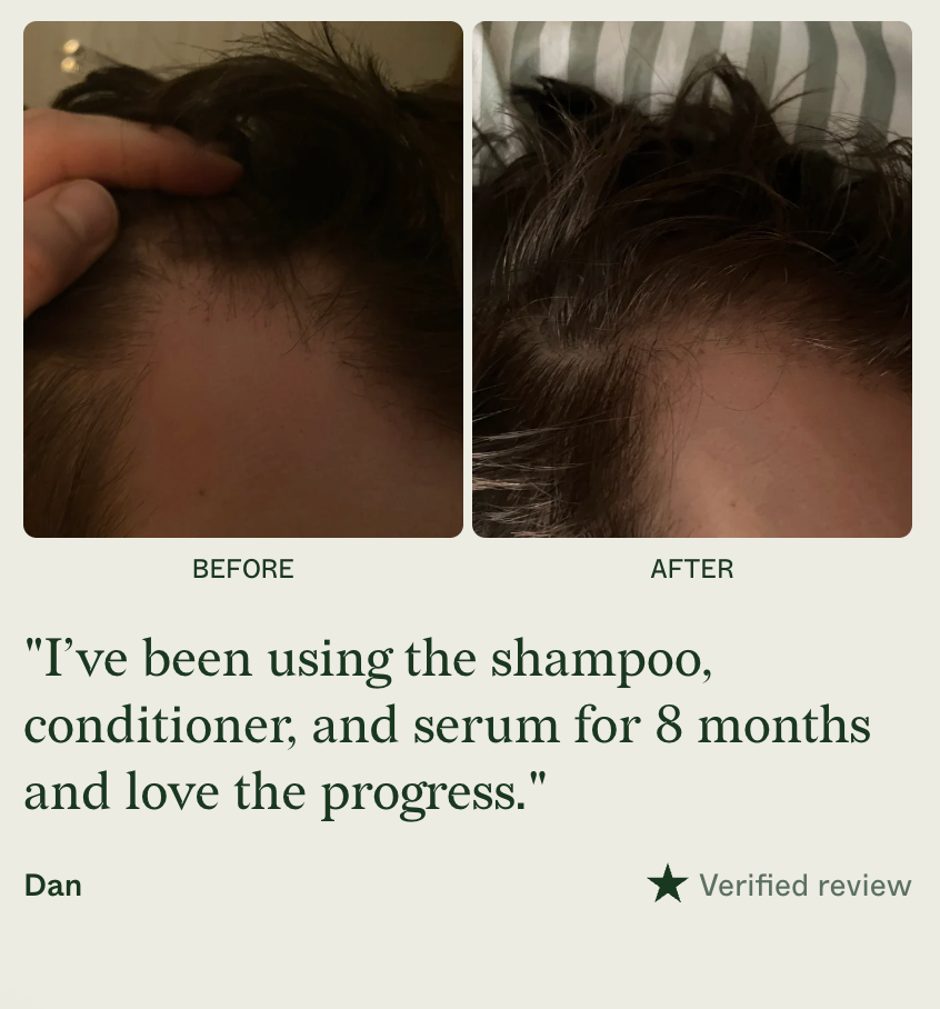 Scandinavian Biolabs Bio-Plixin Shampoo for MEN