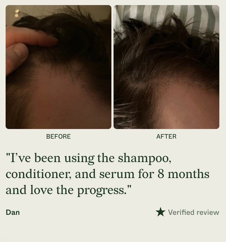 Scandinavian Biolabs Bio-Plixin Conditioner For MEN