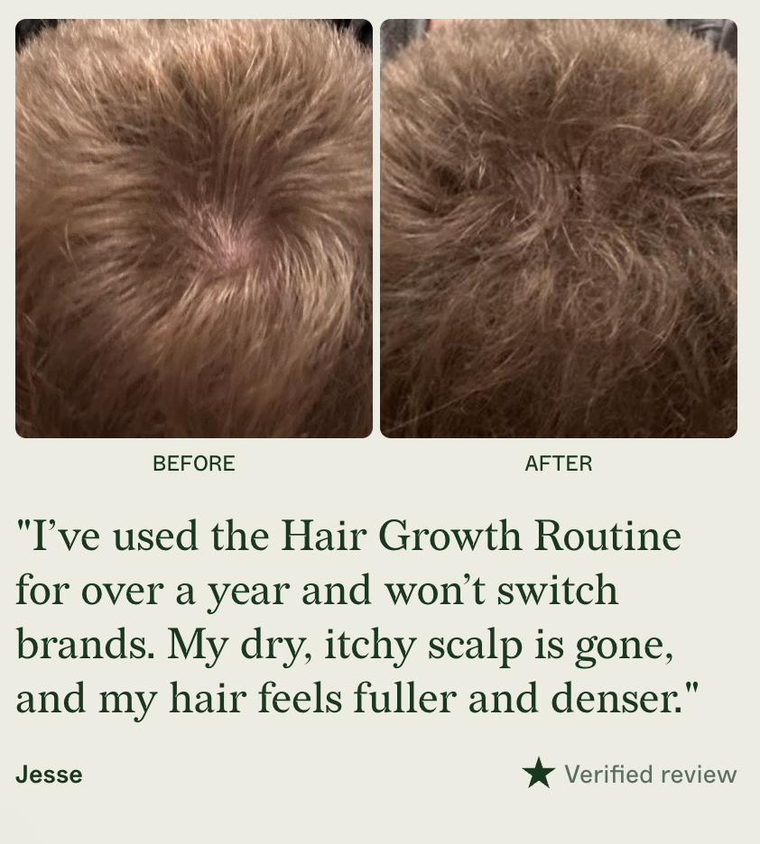 Scandinsvian Biolabs Bio-Pilixin Hairline Booster