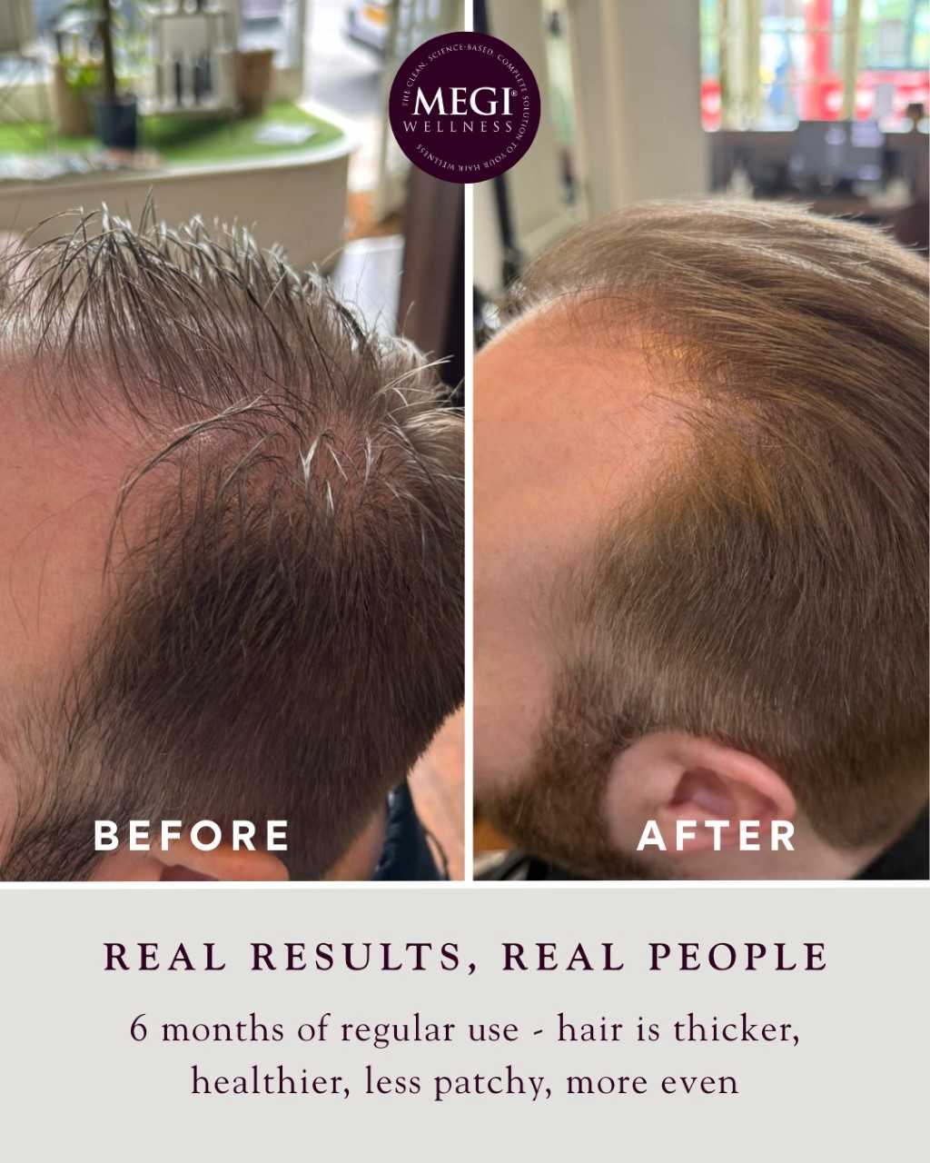 Megi Wellness Growth Stimulating Shampoo