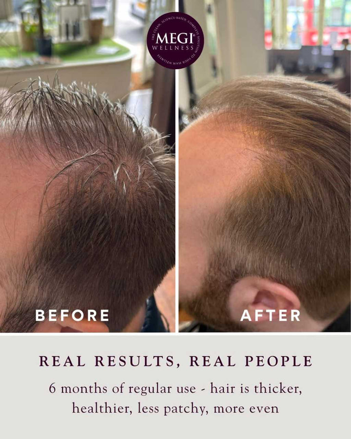 Megi Wellness Growth Stimulating Shampoo