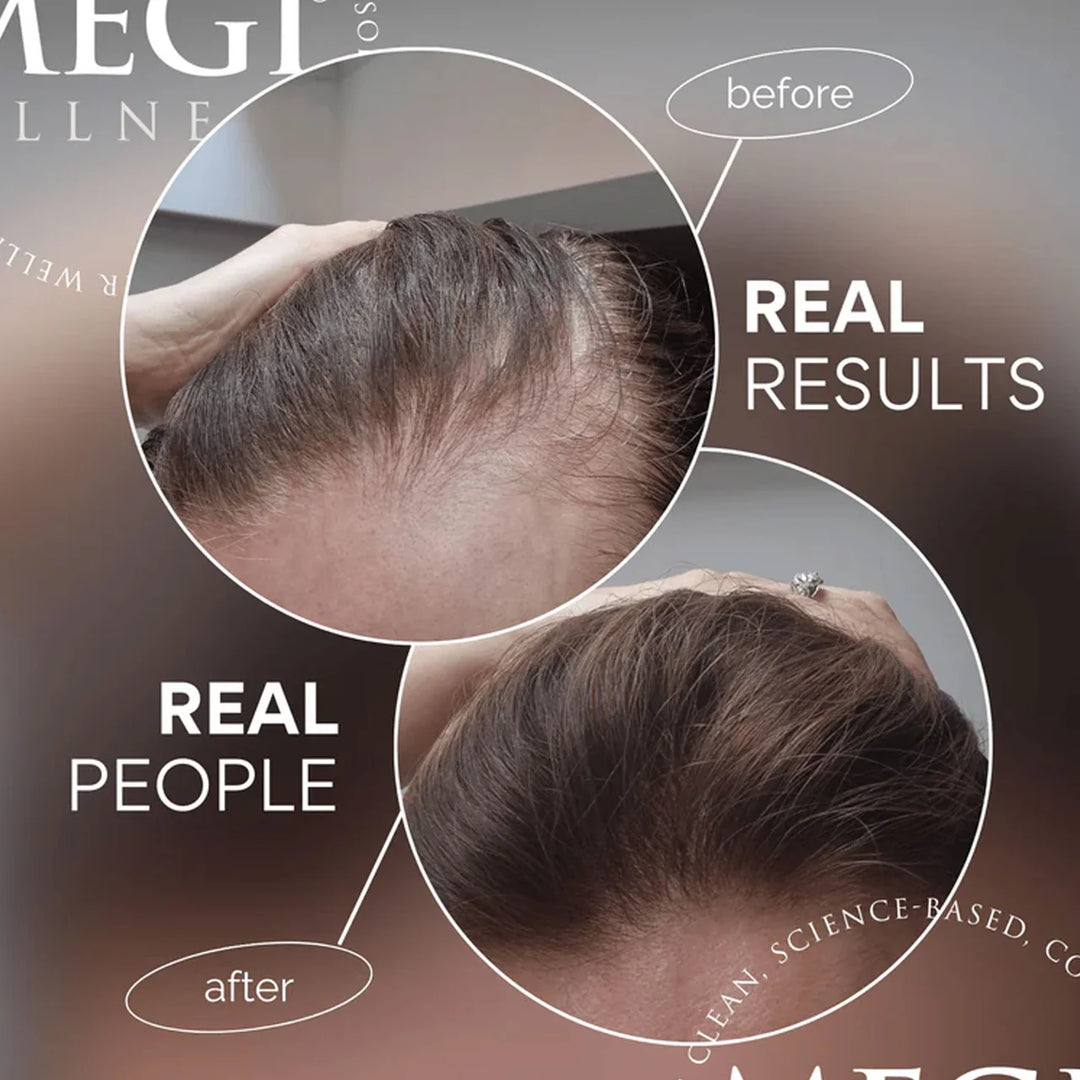 Megi Wellness Growth Stimulating Hair Serum