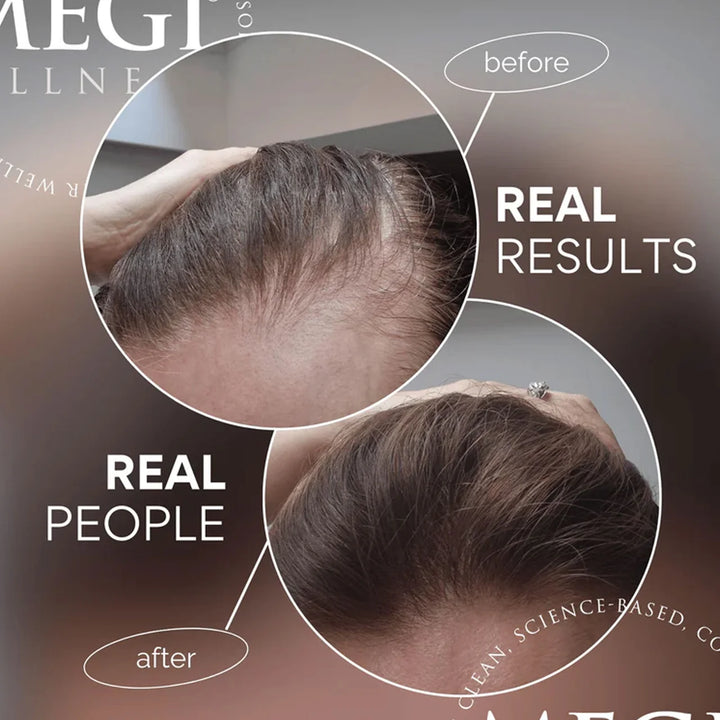 Megi Wellness Growth Stimulating Hair Serum