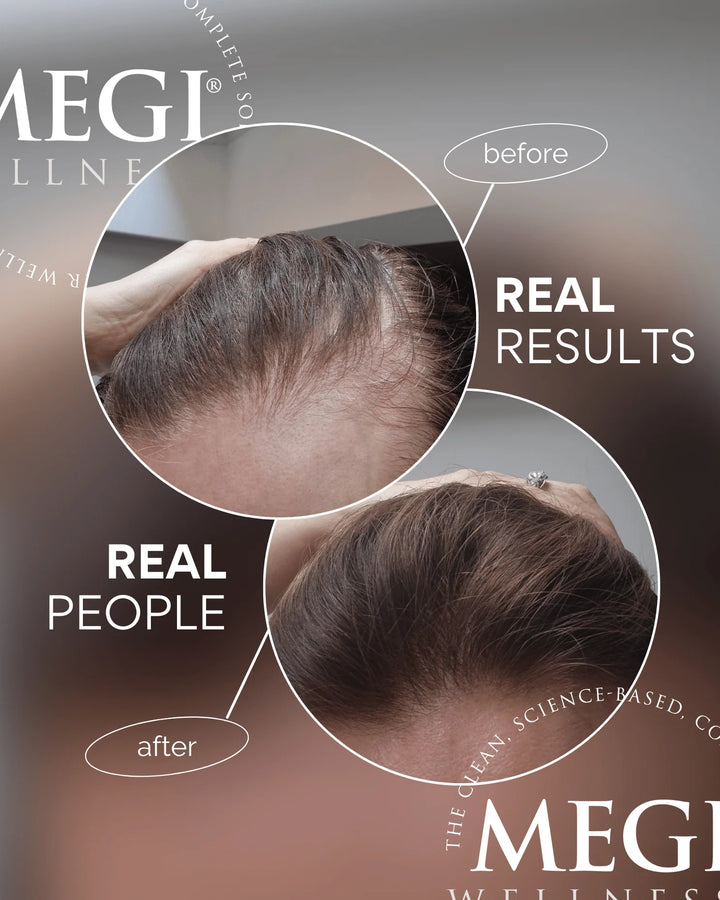 Megi Wellness Growth Stimulating Hair Serum