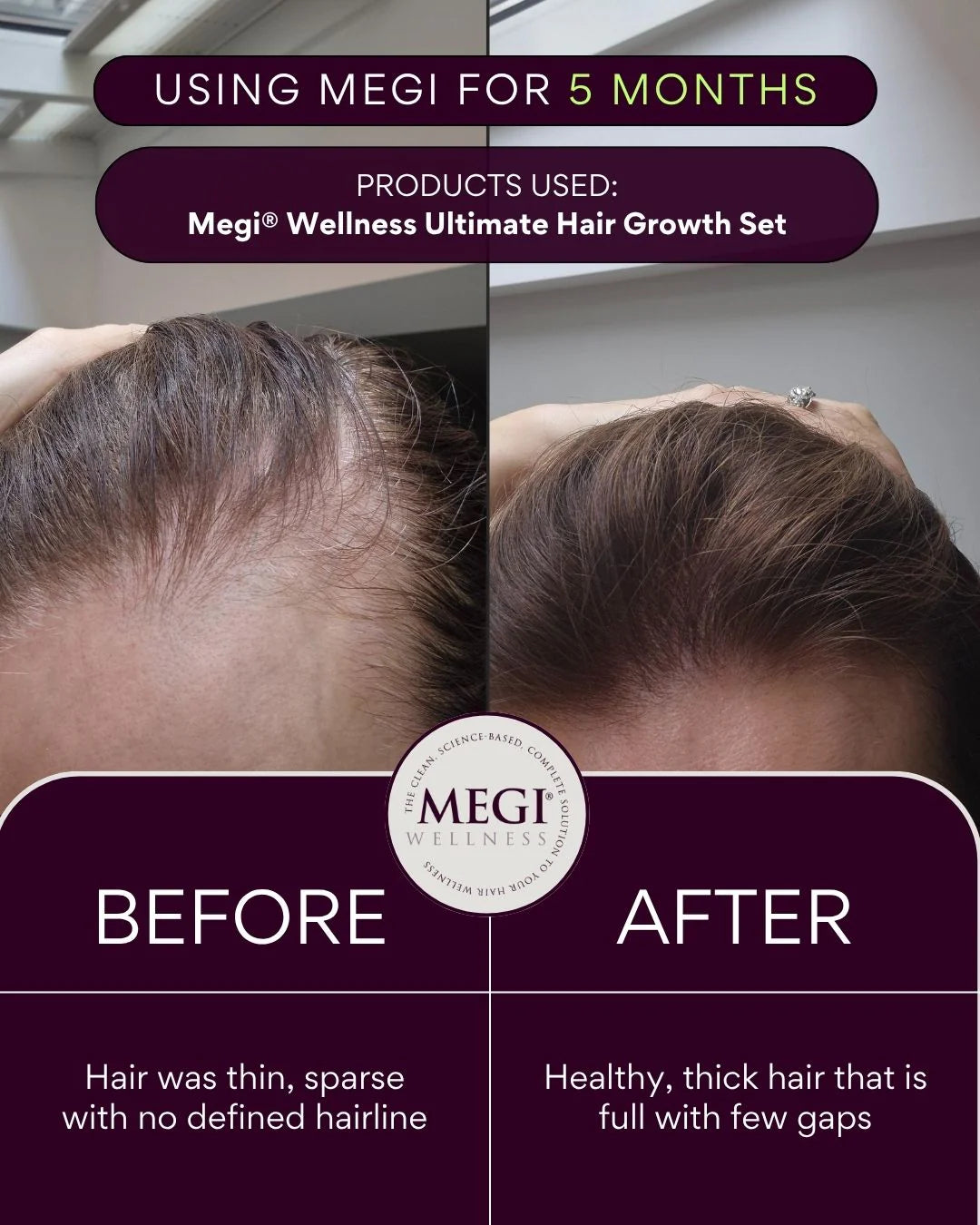 Megi Wellness Advanced Hair Growth Supplement