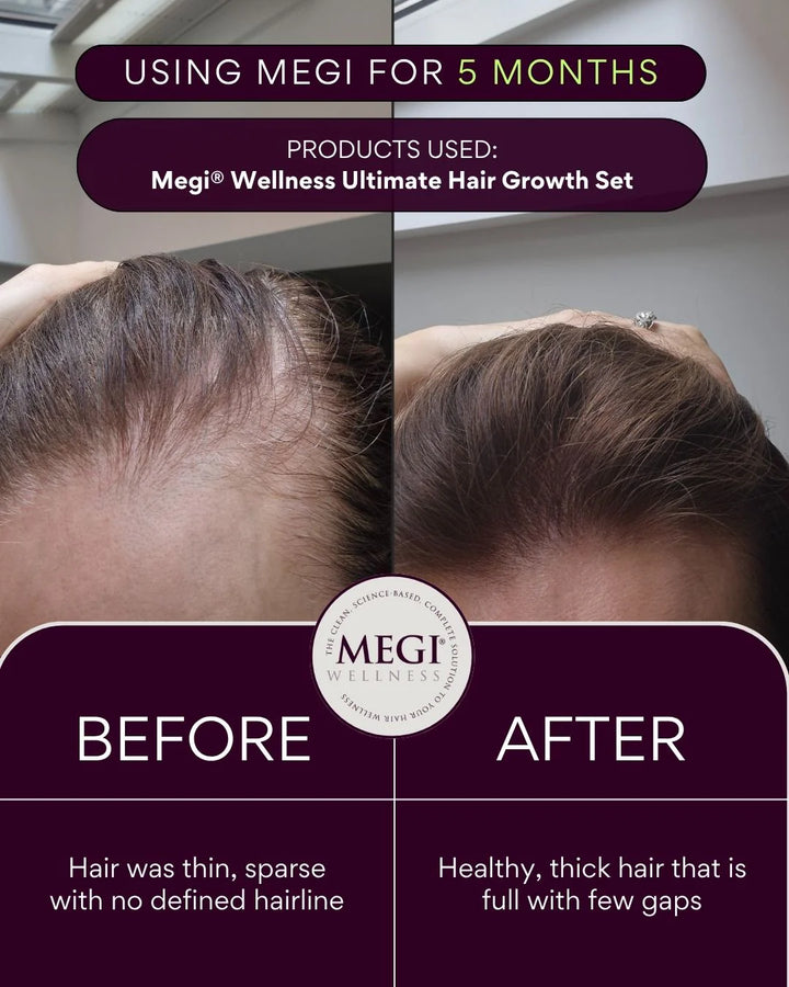 Megi Wellness Advanced Hair Growth Supplement