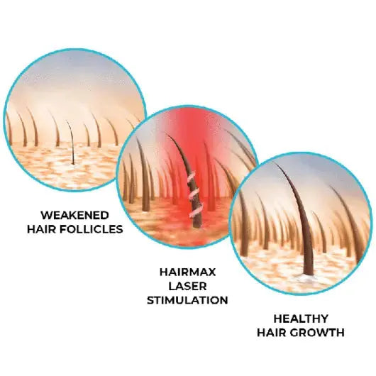 Hairmax LASER 272 POWERFLEX CAP